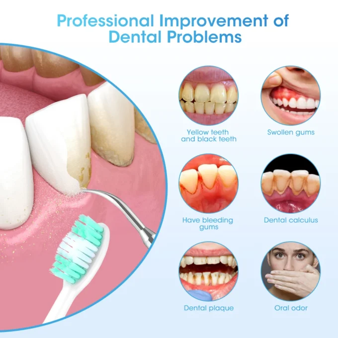 Electric Teeth Cleaner Dental Calculus, Plaque, and Tartar Remover.